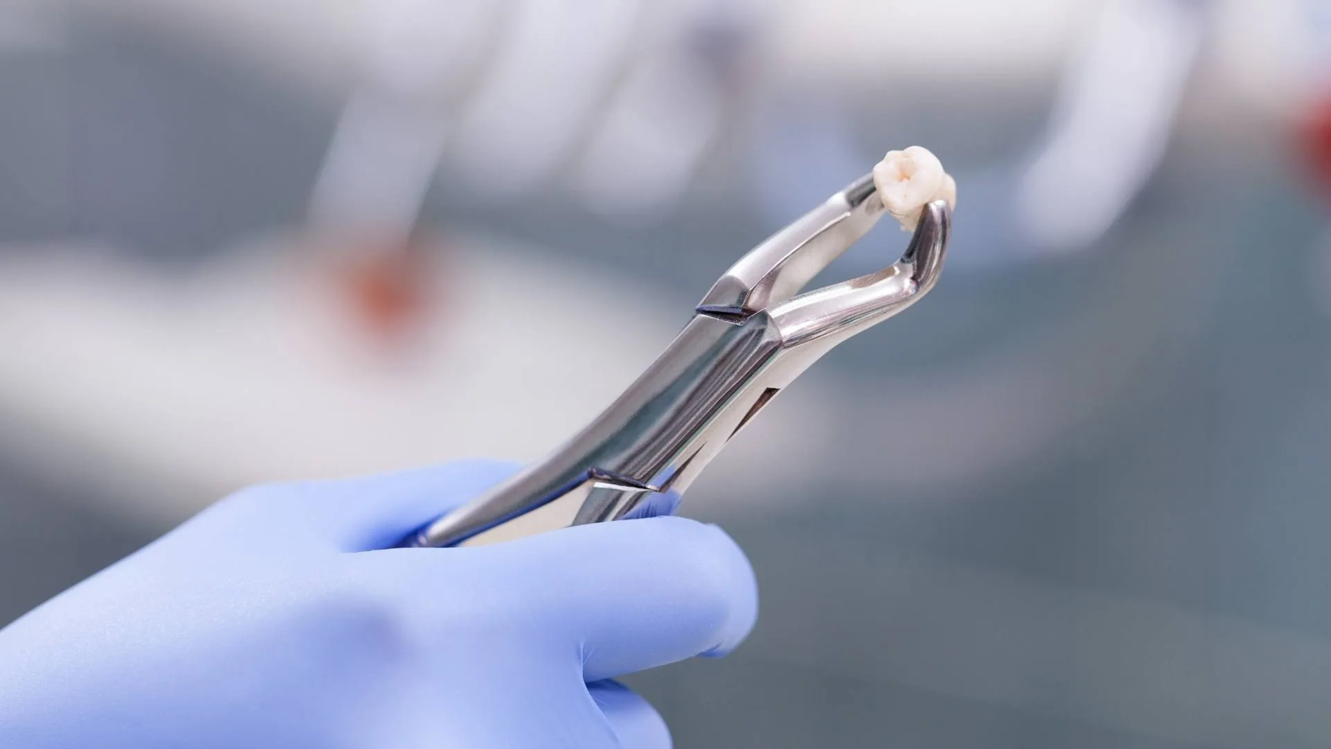 denti del giudizio 3 | estrazionedente.com