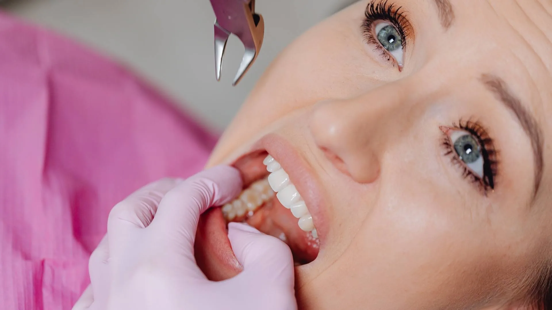 denti del giudizio | estrazionedente.com