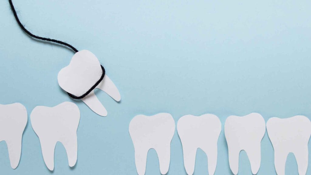 quanto costa togliere un dente del giudizio