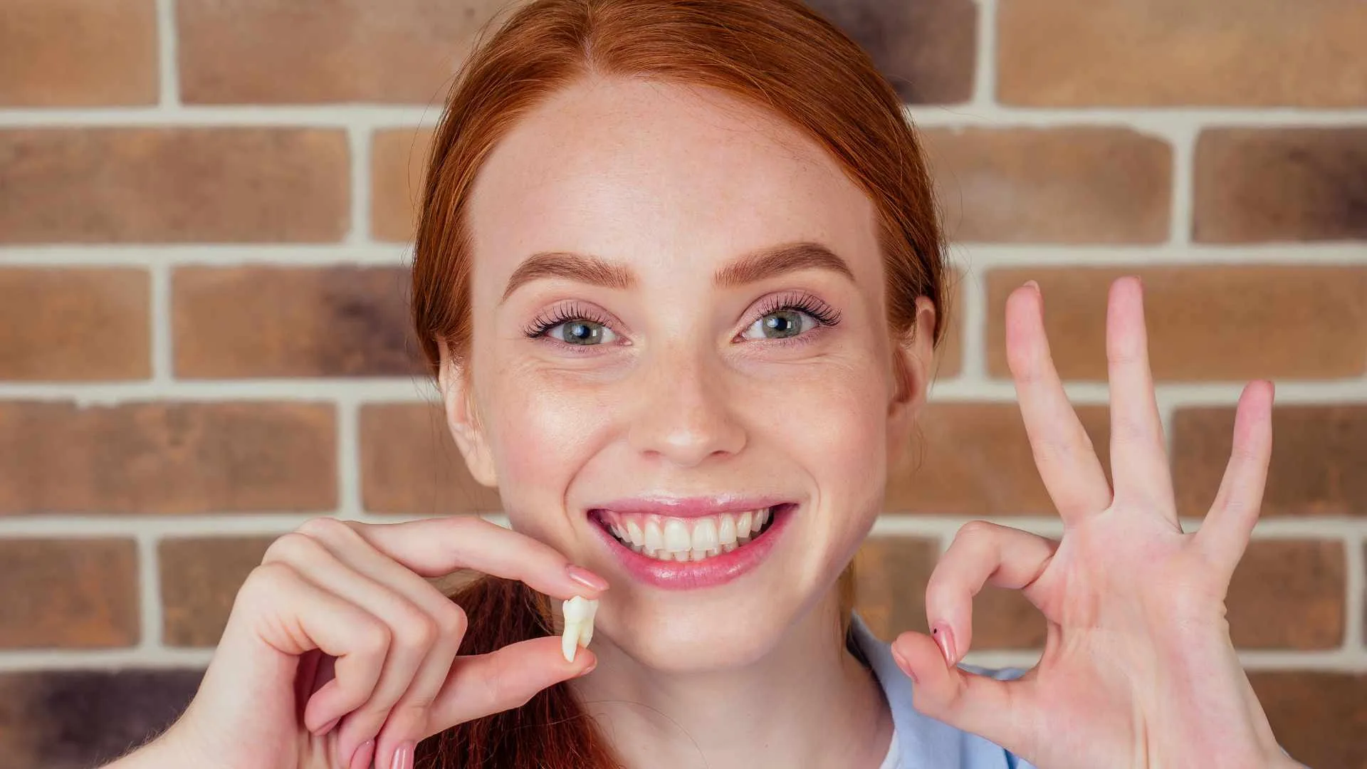 quando togliere i denti del giudizio