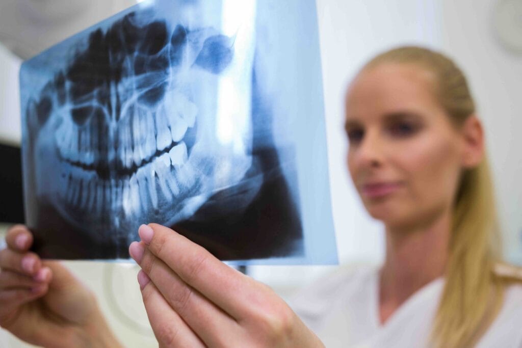 radiografia panoramica