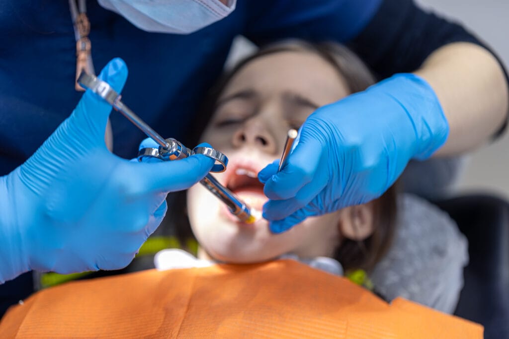 estrarre un dente fa male
