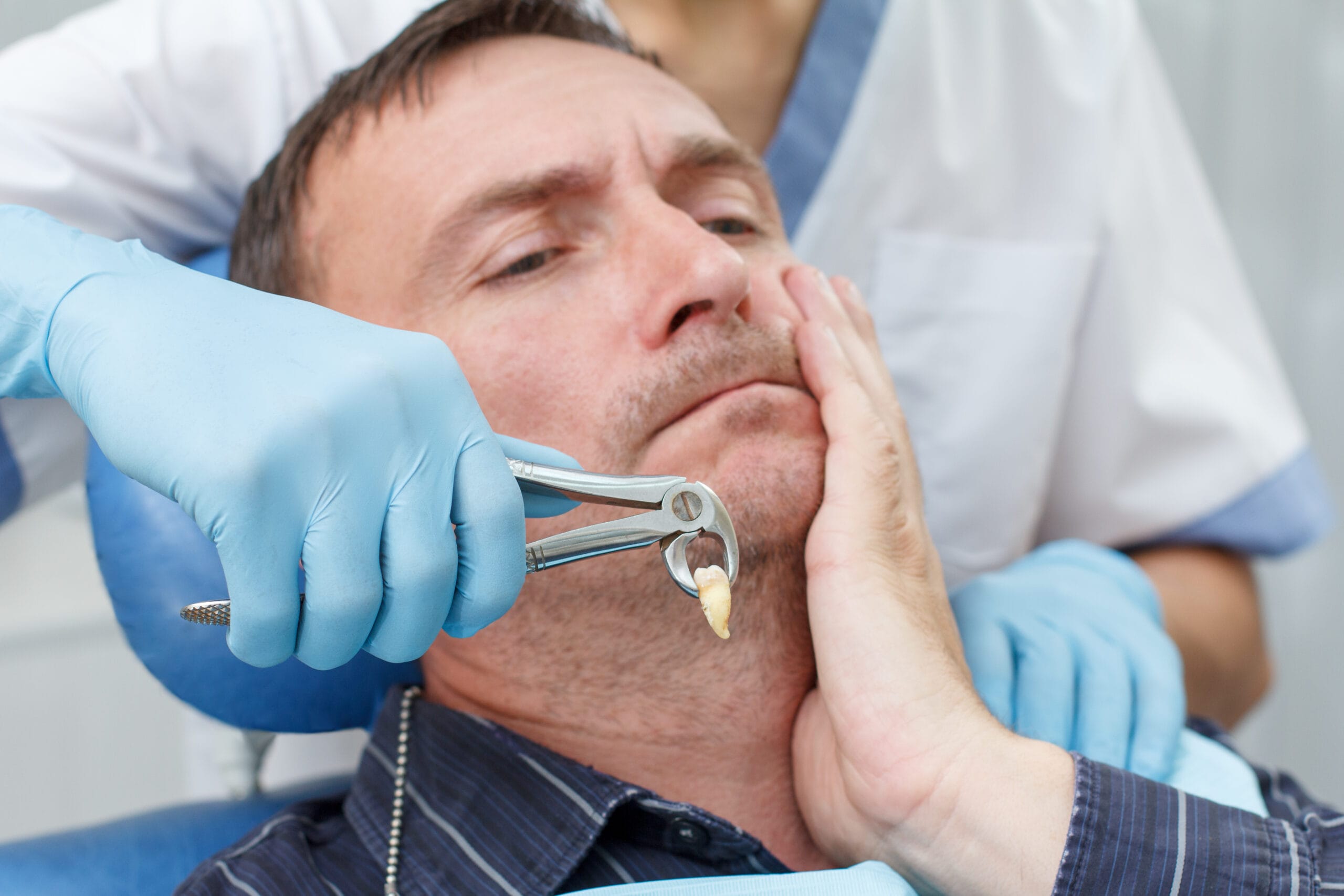 dolore dopo estrazione dente del giudizio